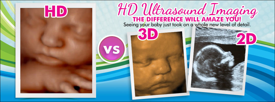 hd ultrasound